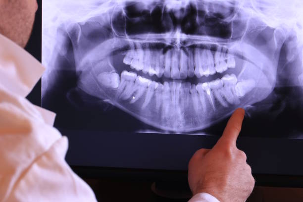 Best Pediatric Emergency Dentist in Tellico Plains, TN
